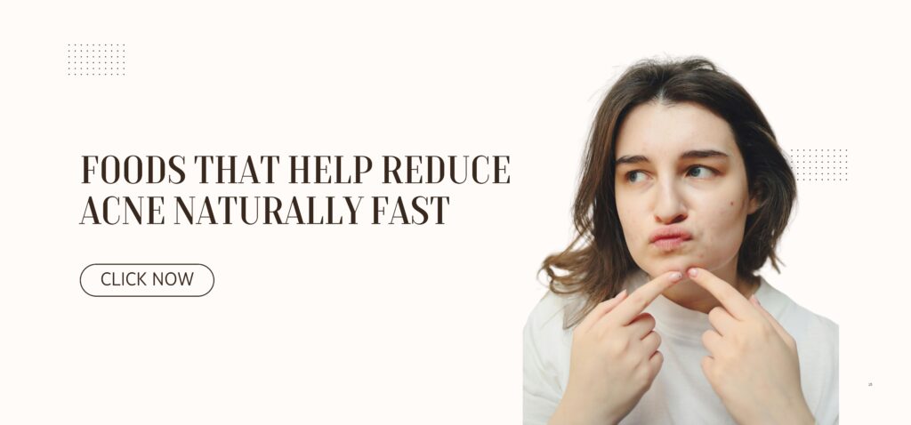 foods that help reduce acne naturally fast