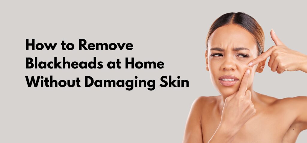 how to remove blackheads at home without damaging skin