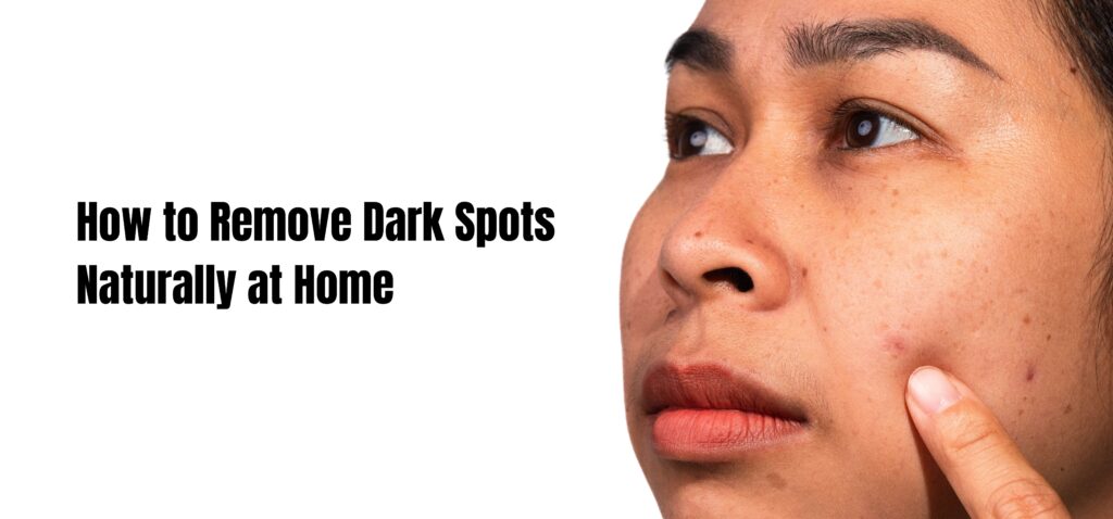how to remove dark spots naturally at home