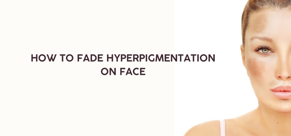 How to Fade Hyperpigmentation on Face