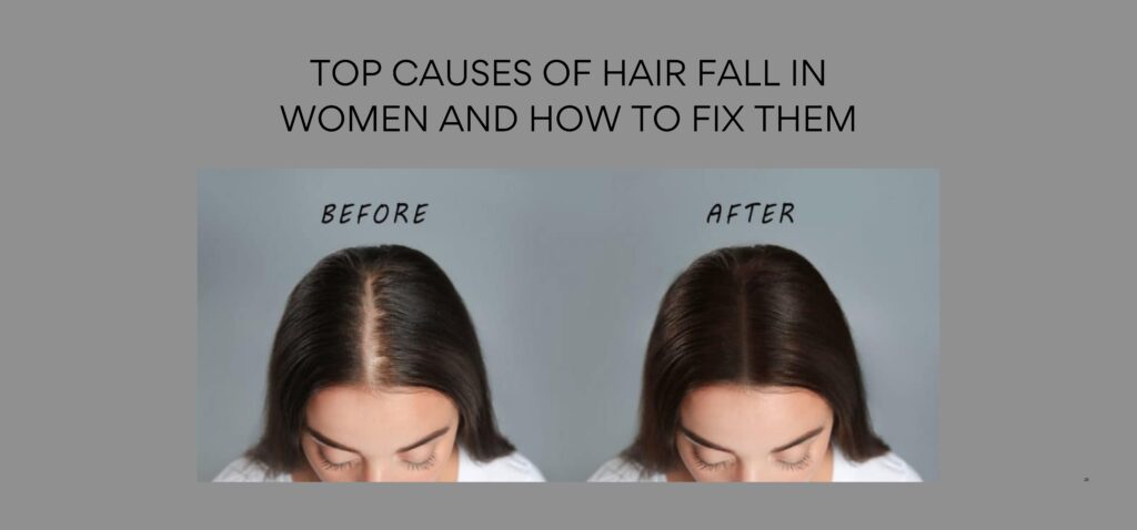 top causes of hair fall in women and how to fix them