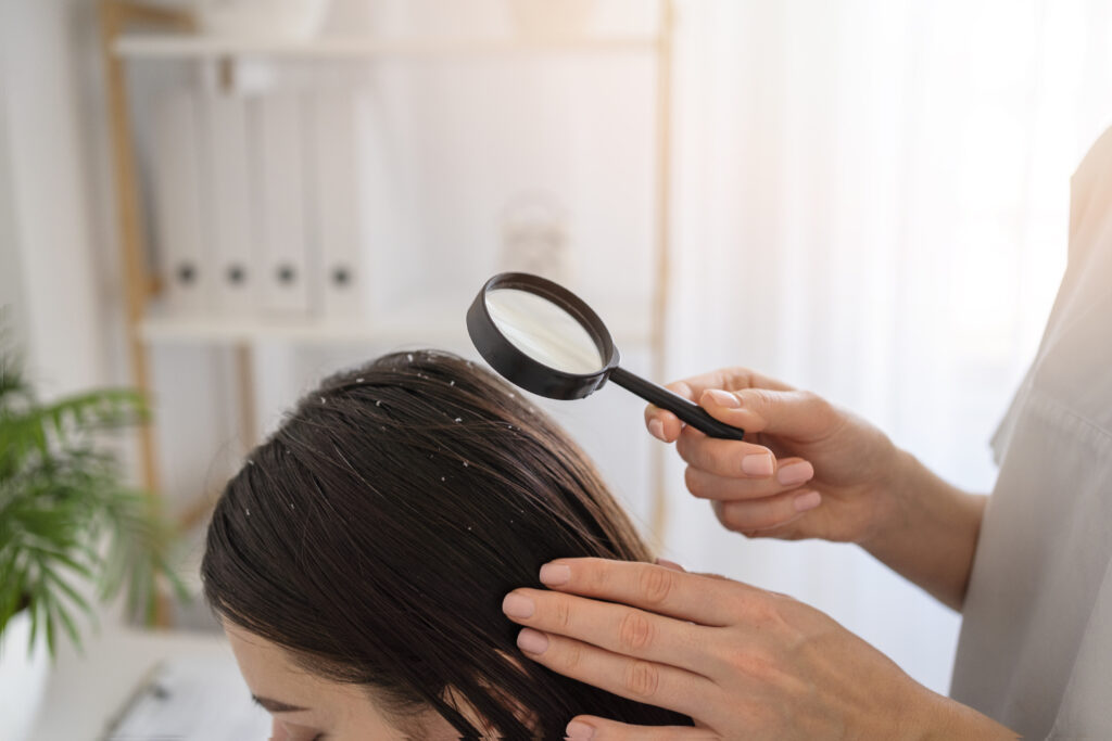 close up woman with dandruff doctor