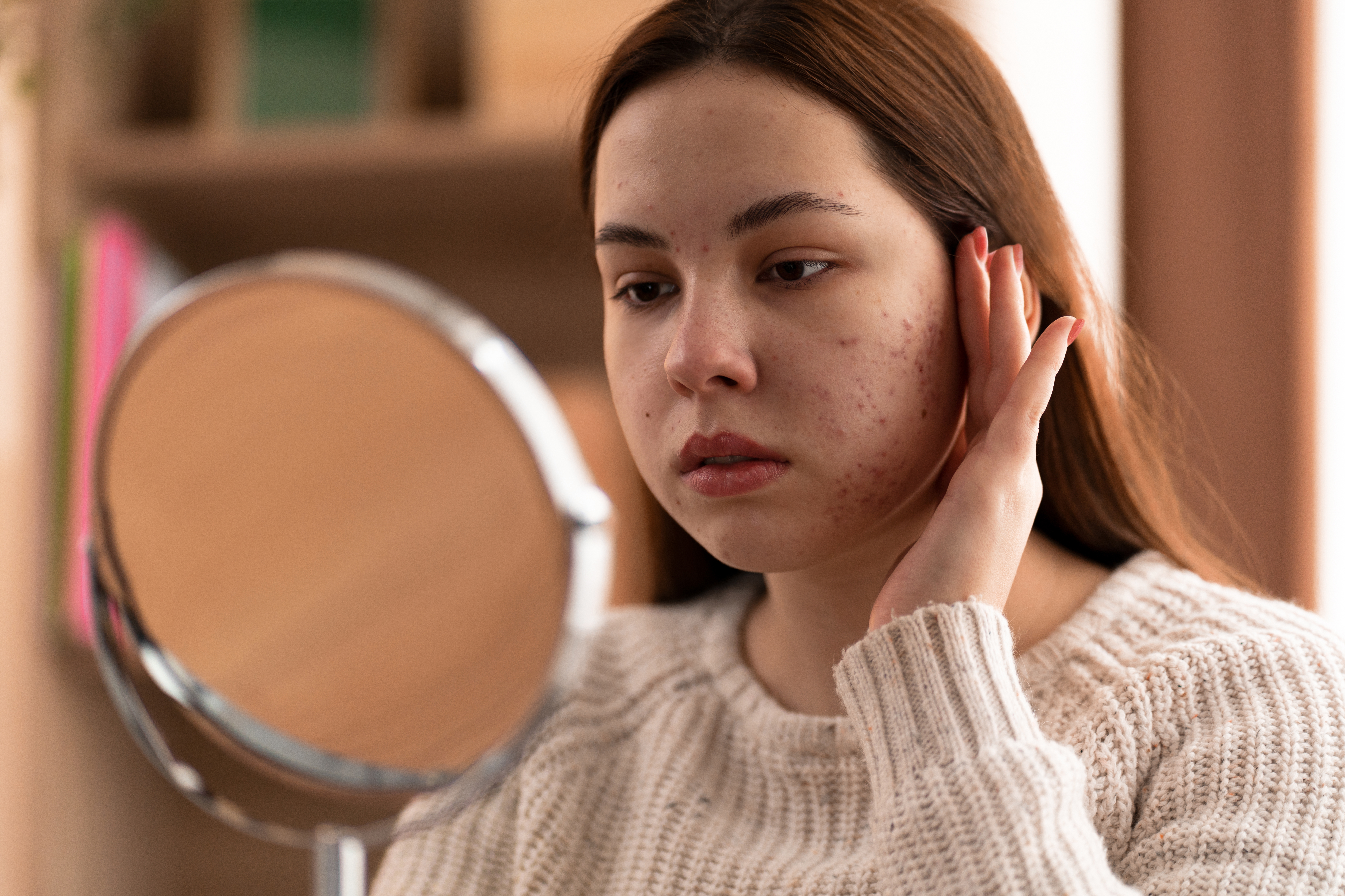 person dealing with rosacea (2)