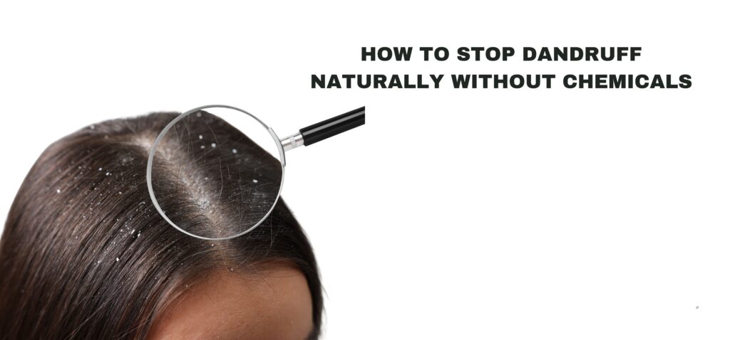 How to Stop Dandruff Naturally Without Chemicals