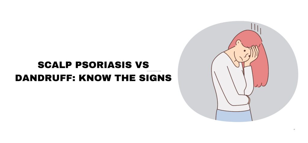 Scalp Psoriasis vs Dandruff Know the Signs